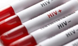 法院裁决终止了艾滋病毒感染者参军的禁令