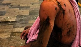 Faisal和Akhyar遭到袭击后，PFAM和Hannah呼吁采取安全措施